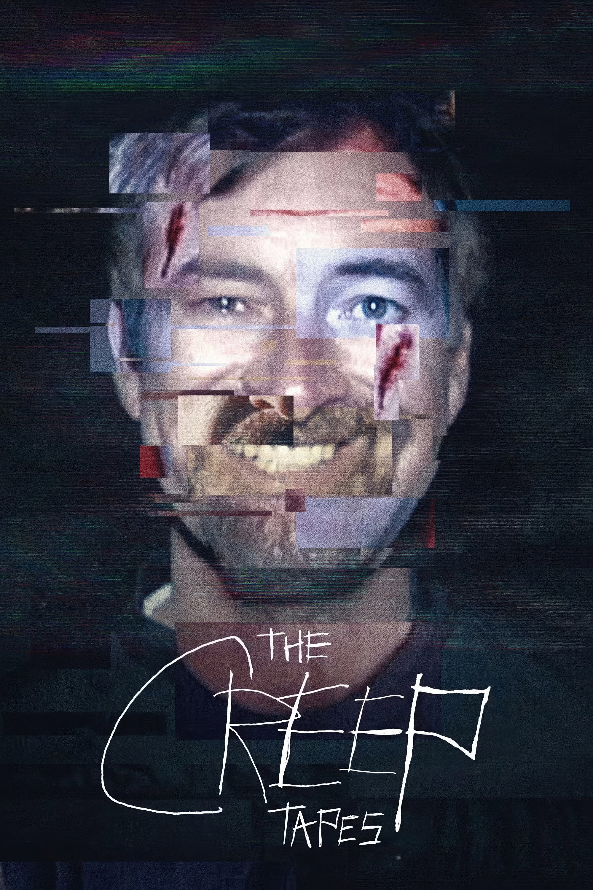 {episode-title}