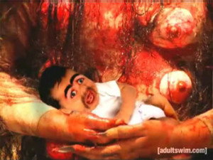 Coma